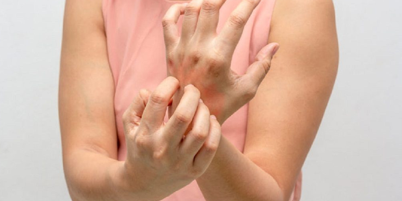 8 bệnh da có nguy cơ lây nhiễm cần cảnh giác